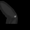 SPORK, NICO - 22.03.1976 - 02.08.2022 - CT obere Extremität - 18:01:46